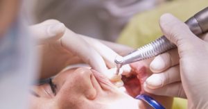 criança - dentista extrair dente