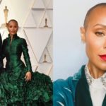 Jada Pinkett Smith - Will Smith alopecia