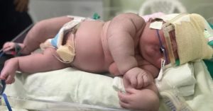 Bebê gigante