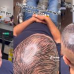 Tatuagem capilar careca