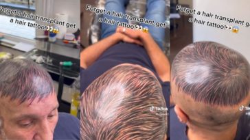 Tatuagem capilar careca