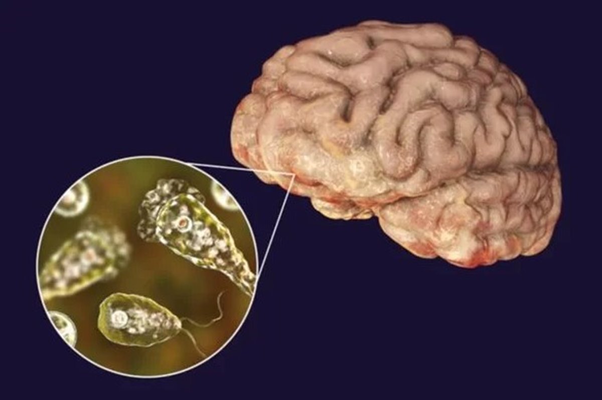 ameba comedora de cérebro - imagem