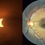 eclipse solar - lesão visão